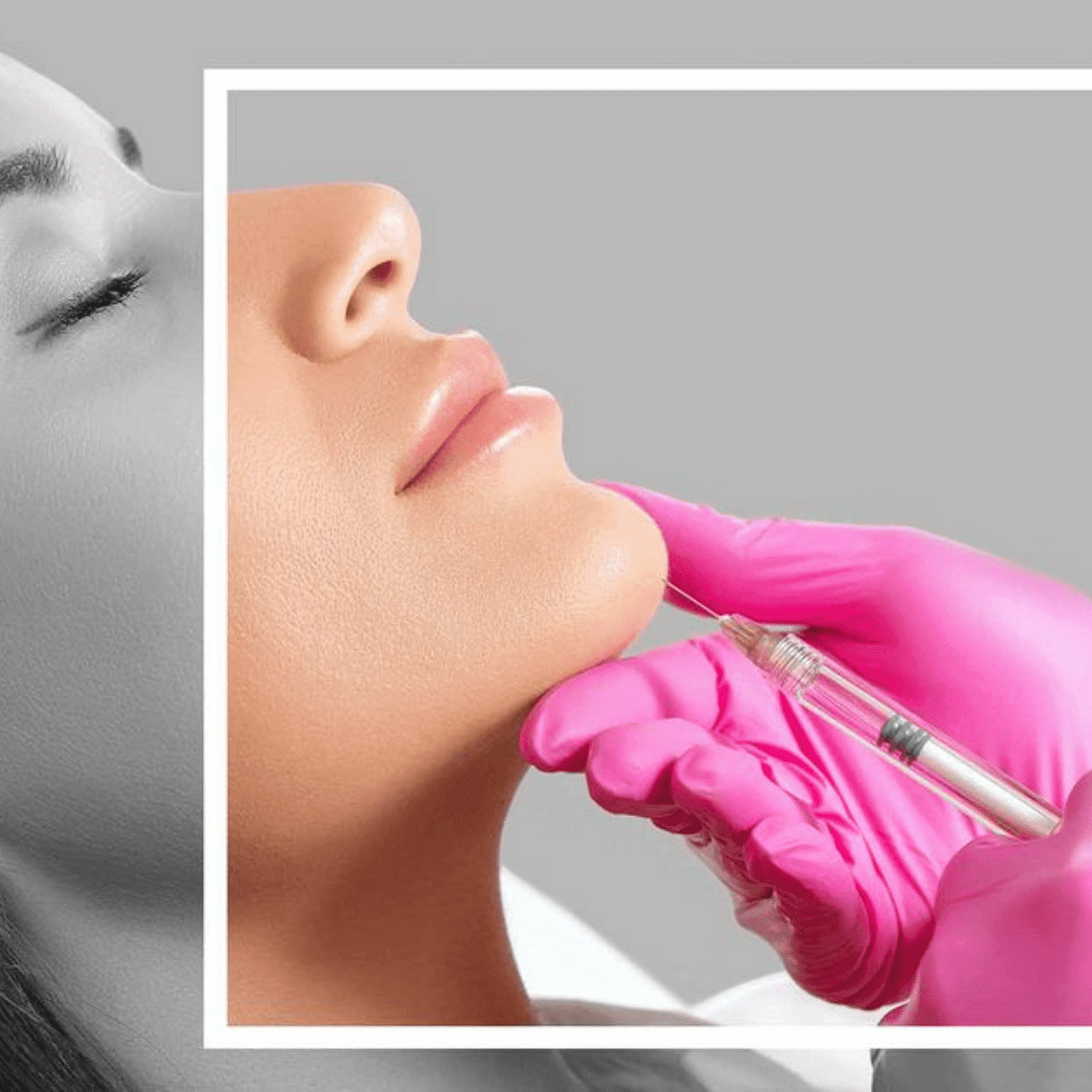 Close-up of person receiving a cosmetic injection in chin by professional in pink gloves.